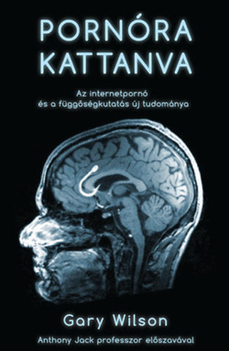 Pornóra kattanva